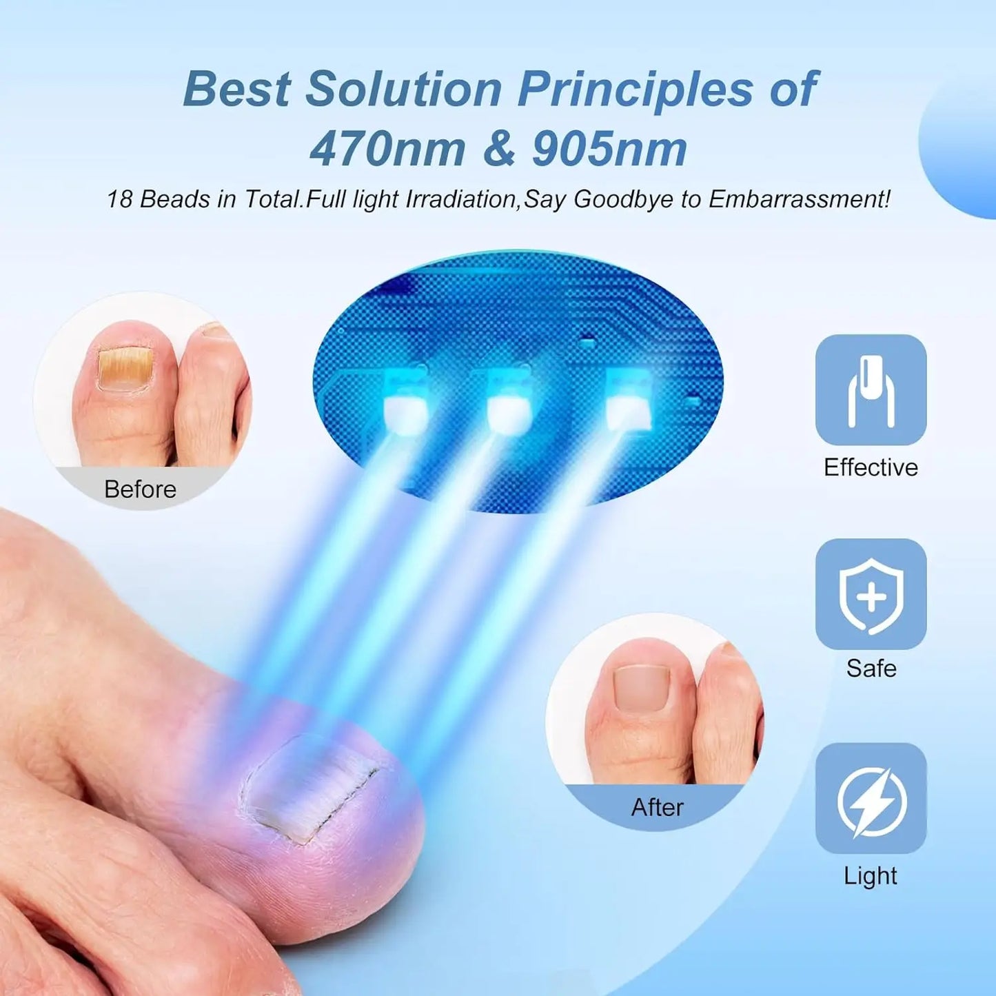 Nail Fungus Laser Device for Multiple Toenail