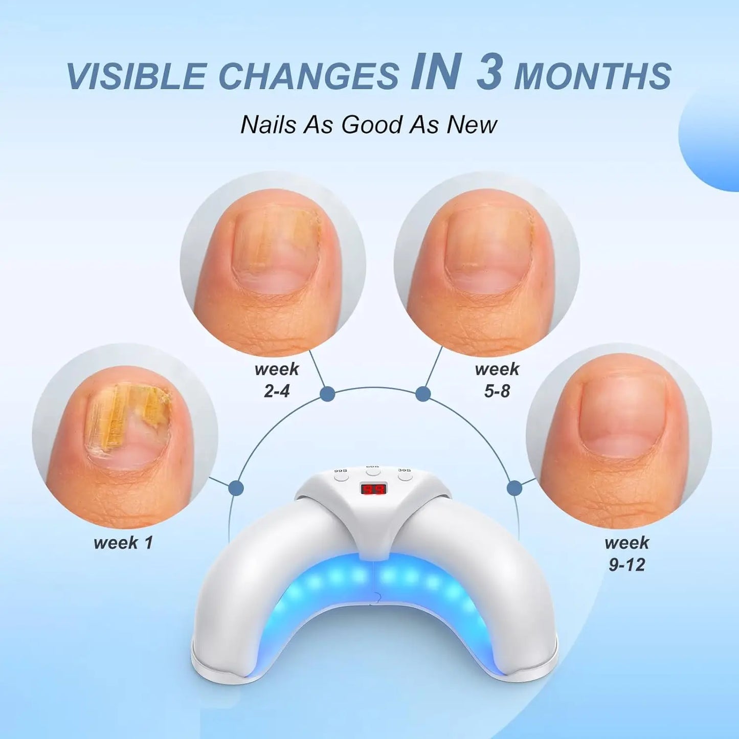 Nail Fungus Laser Device for Multiple Toenail