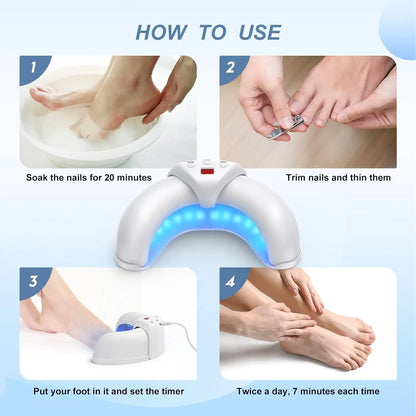 Nail Fungus Laser Device for Multiple Toenail